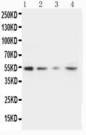 Anti-Stromelysin-2 MMP10 Antibody Picoband® Boster Bio