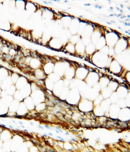 Anti-Metalloproteinase inhibitor 1 TIMP1 Antibody Picoband® Boster Bio