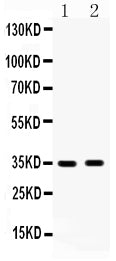 Anti-HSD17B6 Antibody Picoband® Boster Bio