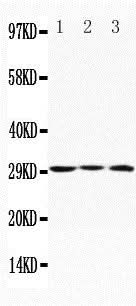 Anti-Apolipoprotein D/APOD Antibody Picoband® Boster Bio