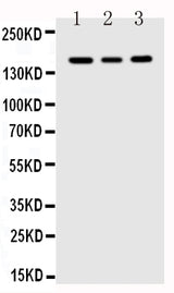 Anti-VEGF Receptor 1/FLT1 Antibody Picoband® Boster Bio