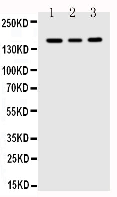 Anti-VEGF Receptor 1/FLT1 Antibody Picoband® Boster Bio