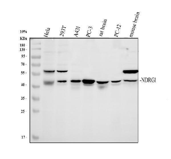 Anti-Protein NDRG1 NDRG1 Antibody Picoband® Boster Bio