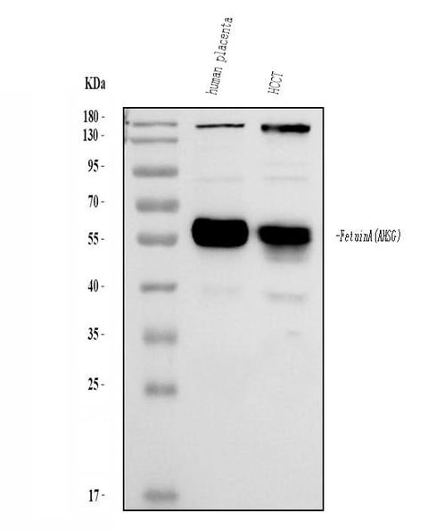Anti-Alpha-2-HS-glycoprotein AHSG Antibody Picoband® Boster Bio