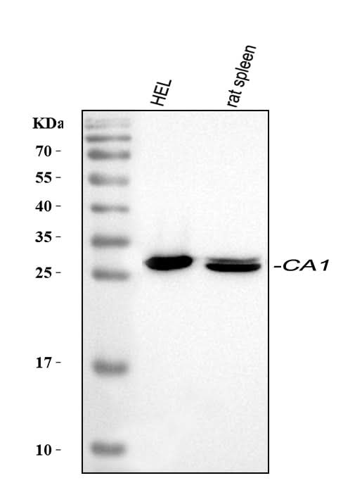 Anti-Carbonic Anhydrase I/CA1 Antibody Picoband® Boster Bio