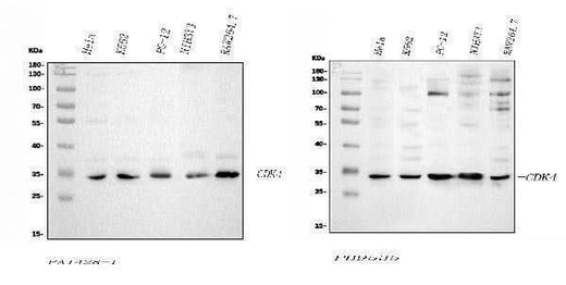 Anti-Cyclin-dependent kinase 4 Cdk4 Antibody Picoband® Boster Bio