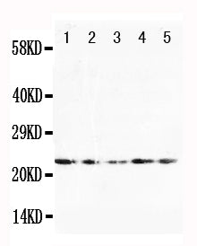 Anti-Fibroblast growth factor 10 FGF10 Antibody Picoband® Boster Bio