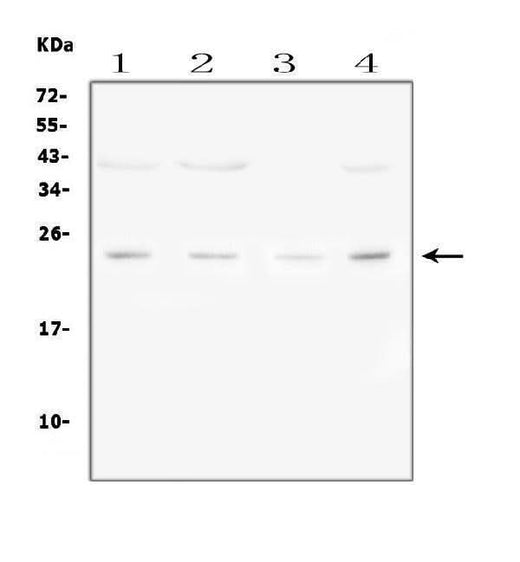 Anti-Fibroblast growth factor 22 FGF22 Antibody Picoband® Boster Bio