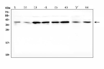 Anti-Dickkopf-related protein 1 DKK1 Antibody Picoband® Boster Bio