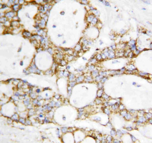 Anti-Lipoamide Dehydrogenase/DLD Antibody Picoband® Boster Bio
