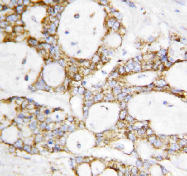 Anti-Lipoamide Dehydrogenase/DLD Antibody Picoband® Boster Bio