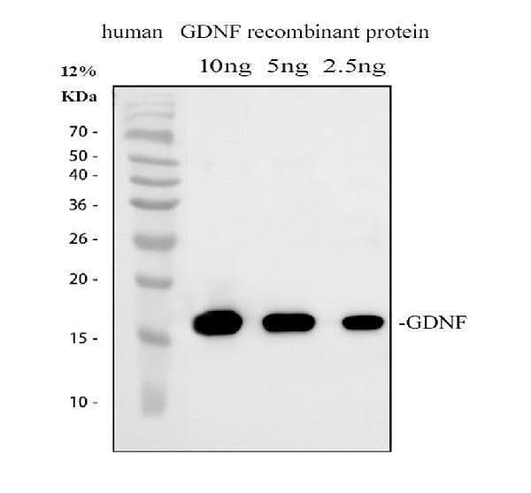 Anti-GDNF Antibody Picoband® Boster Bio