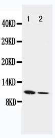 Anti-Resistin/RETN Antibody Picoband® Boster Bio