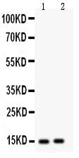 Anti-Fatty Acid Binding Protein 5/FABP5 Antibody Picoband® Boster Bio