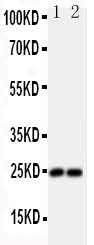 Anti-Fibroblast growth factor 19 FGF19 Antibody Picoband® Boster Bio