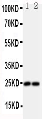 Anti-Fibroblast growth factor 19 FGF19 Antibody Picoband® Boster Bio