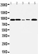 Anti-FGFR1 Antibody Picoband® Boster Bio