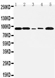 Anti-FGFR1 Antibody Picoband® Boster Bio