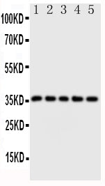 Anti-Fos B/FOSB Antibody Picoband® Boster Bio