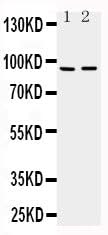 Anti-ADAMTS4/ADAMTS4 Antibody Picoband® Boster Bio
