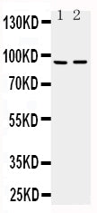 Anti-ADAMTS4/ADAMTS4 Antibody Picoband® Boster Bio