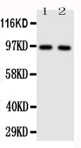 Anti-Toll-like receptor 4 TLR4 Antibody Picoband® Boster Bio