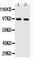 Anti-Toll-like receptor 4 TLR4 Antibody Picoband® Boster Bio