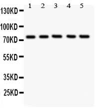 Anti-12 Lipoxygenase/ALOX12 Antibody Picoband® Boster Bio