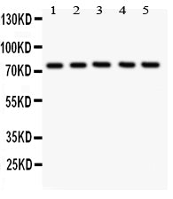 Anti-12 Lipoxygenase/ALOX12 Antibody Picoband® Boster Bio