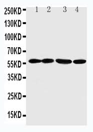 Anti-Angiopoietin-related protein 1 ANGPTL1 Antibody Picoband® Boster Bio