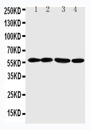 Anti-Angiopoietin-related protein 1 ANGPTL1 Antibody Picoband® Boster Bio