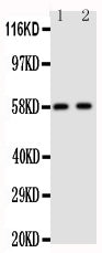 Anti-Aromatase/CYP19A1 Antibody Picoband® Boster Bio