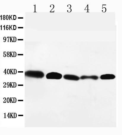 Anti-GPR2/CCR10 Antibody Picoband® Boster Bio