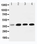Anti-IGFBP3 Antibody Picoband® Boster Bio