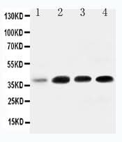 Anti-IGFBP3 Antibody Picoband® Boster Bio