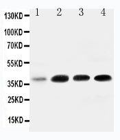 Anti-IGFBP3 Antibody Picoband® Boster Bio