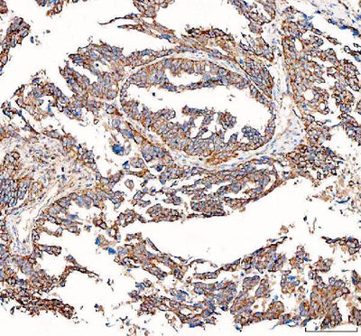 Anti-BCAT2 Antibody Picoband® Boster Bio