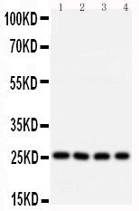 Anti-B-cell lymphoma/leukemia 10 Bcl10 Antibody Picoband® Boster Bio