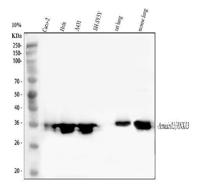 Anti-Annexin A3/ANXA3 Antibody Picoband® Boster Bio