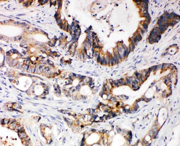 Anti-XIAP Antibody Picoband® Boster Bio