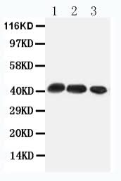 Anti-C-C chemokine receptor type 4 CCR4 Antibody Picoband® Boster Bio