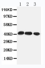 Anti-C-C chemokine receptor type 4 CCR4 Antibody Picoband® Boster Bio