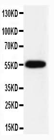 Anti-Caspase-8(P10)/CASP8 Antibody Picoband® Boster Bio
