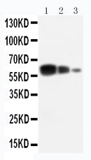 Anti-ADAM10/ADAM10 Antibody Picoband® Boster Bio