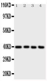 Anti-ATF4 Antibody Picoband® Boster Bio
