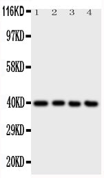 Anti-ATF4 Antibody Picoband® Boster Bio