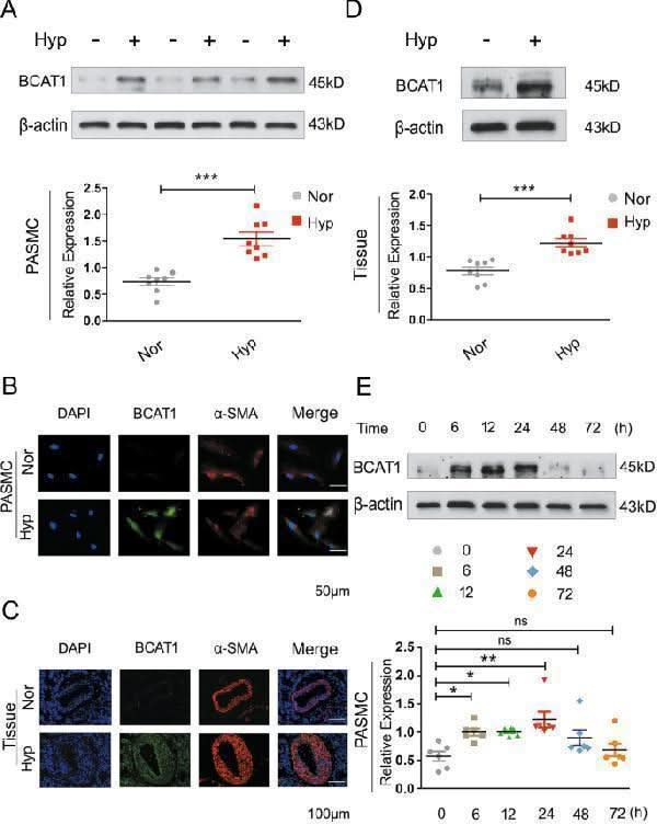 Anti-BCAT1 Antibody Picoband® Boster Bio