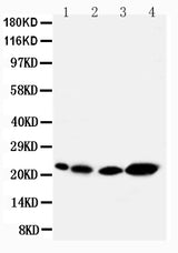 Anti-Caveolin-2/CAV2 Antibody Picoband® Boster Bio