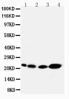 Anti-Caveolin-2/CAV2 Antibody Picoband® Boster Bio