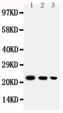 Anti-BAFF/TNFSF13B Antibody Picoband® Boster Bio